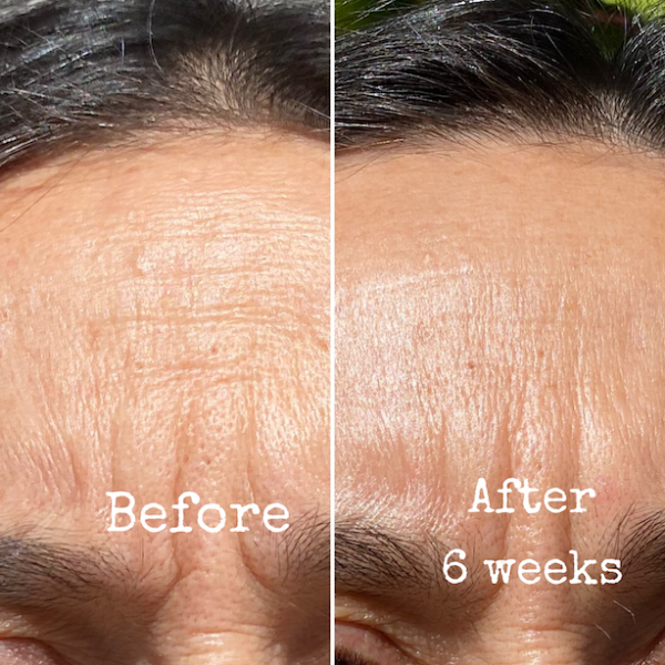 Pure Ceuticals Retinol & Lactic Resurfacing Serum